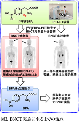 図3. BNCT実施に至るまでの流れ